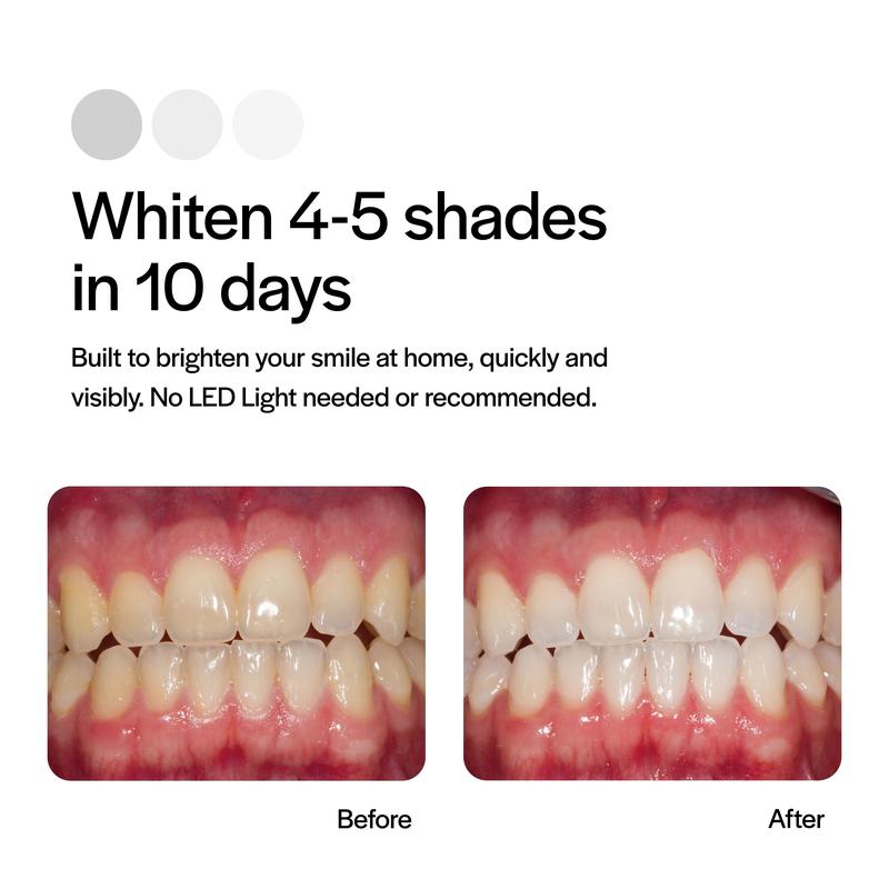 Tropiac Prefilled Whitening Trays