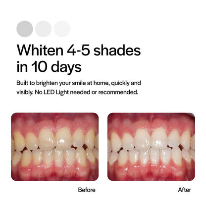 Tropiac Prefilled Whitening Trays